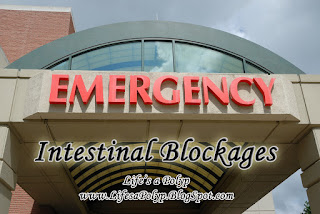 intestinal blockages  life's a polyp