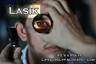 Lasik – Eye Surgery