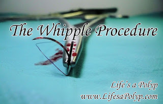 The Whipple Procedure