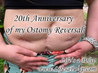 Ostomy Reversal Anniversary – 20 Years