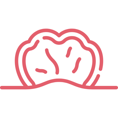 A graphic icon of a gastric polyp